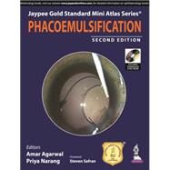 Phacoemulsification by Agarwal, Amar; Narang, Priya, 9789351527848