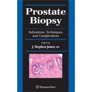 Prostate Biopsy by Jones, J. Stephen, 9781588297907