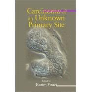 Carcinoma of an Unknown Primary Site by Fizazi; Karim, 9780824727994