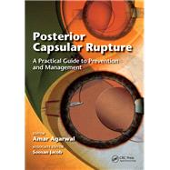 Posterior Capsular Rupture by Amar Agarwal, 9781041257998