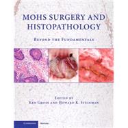 Mohs Surgery and Histopathology: Beyond the Fundamentals by Edited by Ken Gross , Howard K. Steinman, 9780521888042