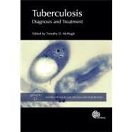 Tuberculosis by McHugh, Timothy D., 9781845938079