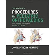 Tachdjian's Procedures in Pediatric Orthopaedics: From the Texas Scottish Rite Hospital for Children by Herring, John A., M.D., 9780323448086