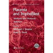 Placenta and Trophoblast by Soares, Michael J.; Hunt, Joan S., 9781627038133