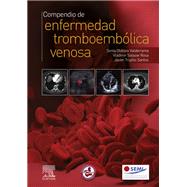 Compendio de enfermedad tromboemblica venosa by Sonia del Pilar Otlora Valderrama; Vladimir Salazar Rosa; Antonio Javier Trujillo Santos, 9788491138143