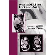 Practical MRI of the Foot and Ankle by Spouge, Alison R., M.D.; Pope, Thomas L., M.D., 9780367398156