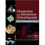 Intraoperative and Interventional Echocardiography by Oxorn, Donald C., M.D.; Otto, Catherine M., M.d., 9780323358255