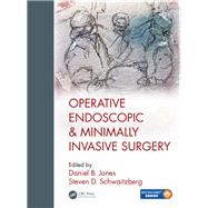 Operative Endoscopic and Minimally Invasive Surgery by Jones; Daniel B., 9781498708302