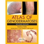 Atlas of Genodermatoses, Second Edition by Tadini; Gianluca, 9781466598355