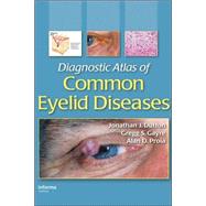 Diagnostic Atlas of Common Eyelid Diseases by Dutton; Jonathan J., 9780824728397