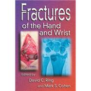 Fractures of the Hand And Wrist by Ring; David C., 9780824728458