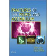 Fractures of the Pelvis And Acetabulum by Smith; Wade  R., 9780824728465