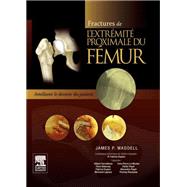 Fractures de l'extrmit proximale du fmur by James P. Waddell; Fabrice Duparc, 9782294728471