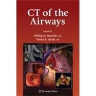 Ct of the Airways by Boiselle, Phillip M.; Lynch, David A., M.D., 9781588298485