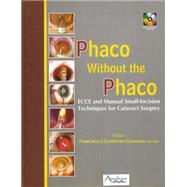 Phaco Without the Phaco by Gutierrez-carmona, Francisco J., M.D., Ph.D., 9781904798507