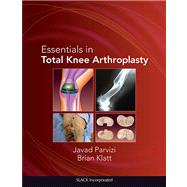 Essentials in Total Knee Arthroplasty by Parvizi, Javad; Klatt, Brian, 9781556428517