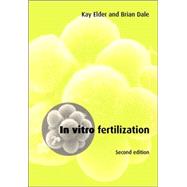 In Vitro Fertilization by Kay Elder , Brian Dale, 9780521778633