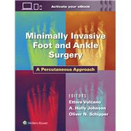 Minimally Invasive Foot and Ankle Surgery A Percutaneous Approach by Vulcano, Ettore; Johnson, Holly; Schipper, Oliver, 9781975198701