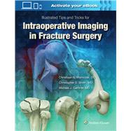 Illustrated Tips and Tricks for Intraoperative Imaging in Fracture Surgery by Gardner, Michael J., 9781496328960
