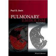 Pulmonary Embolism by Stein, Paul D., 9781119039082