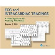 ECG and Intracardiac Tracings by Klein, George J., M.D., 9781942909255