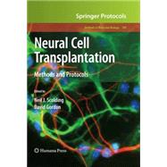Neural Cell Transplantation by Scolding, Neil J.; Gordon, David, 9781603279307