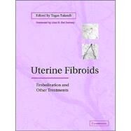 Uterine Fibroids: Embolization and other Treatments by Edited by Togas Tulandi, 9780521819381
