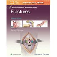 Master Techniques in Orthopaedic Surgery: Fractures by Gardner, Michael J., 9781975139407