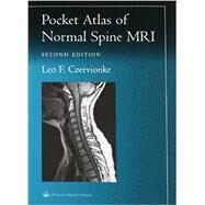 Pocket Atlas of Spinal MRI by Czervionke, Leo F., 9780781729482