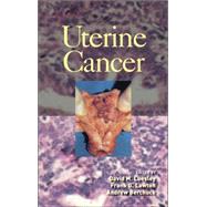 Uterine Cancer by Luesley; David M., 9780824759513