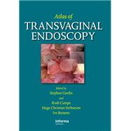 Atlas of Transvaginal Endoscopy by Gordts, Stephan; Verhoeven, Hugo C.; Campo, Rudi; Brosens, Ivo, 9780367389543