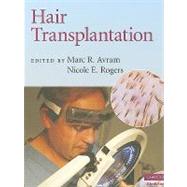 Hair Transplantation by Marc R.  Avram , Nicole E. Rogers, 9780521879675