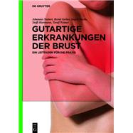 Gutartige Erkrankungen Der Brust by Stubert, Johannes; Gerber, Bernd; Stachs, Angrit; Hartmann, Steffi; Reimer, Toralf, 9783110609813