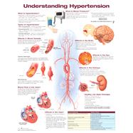 Understanding Hypertension by Anatomical Chart Company, 9781496369819