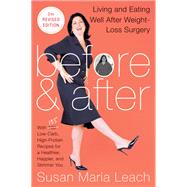Before & After: Living and Eating Well After Weight-Loss Surgery by Leach, Susan Maria, 9780062239990