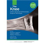 The Knee AANA Advanced Arthroscopic Surgical Techniques by Sgaglione, Nicholas A; Lubowitz, James H; Provencher, Matthew, 9781617119996